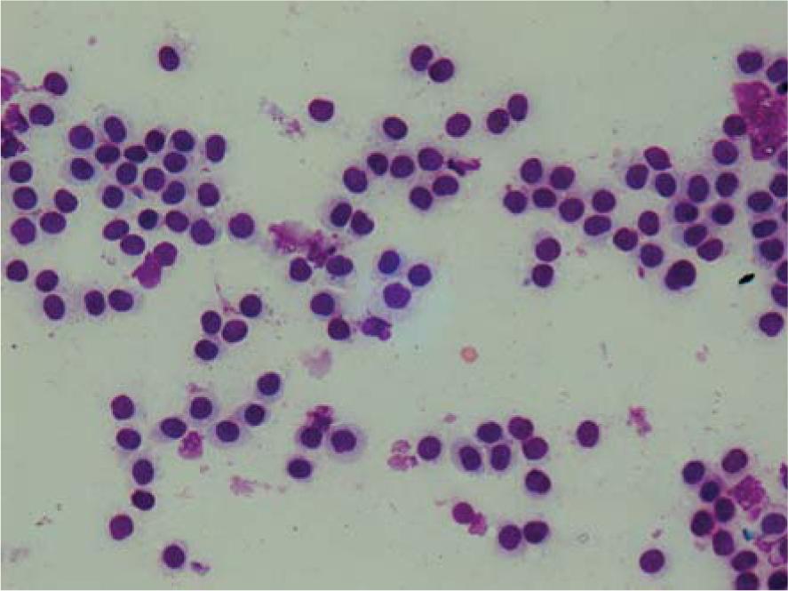 Cytological presentation of mast cell tumours (Tumour 2). Hemacolor, 400 x.