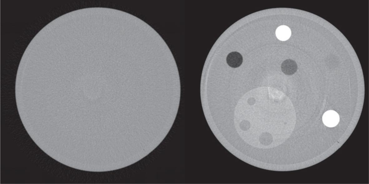 Example of reconstructed water image (left panel) and detail image (right panel), acquired at 38 keV and high dose.