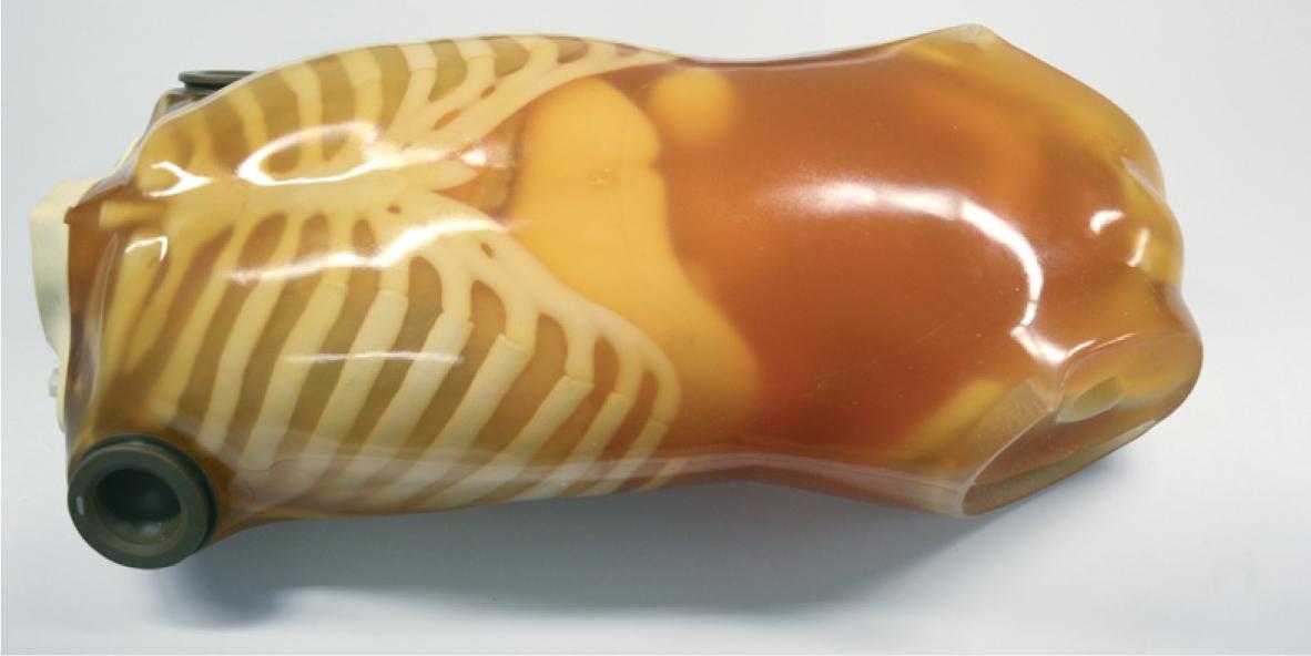 Image of the anthropomorphic phantom used in the study.