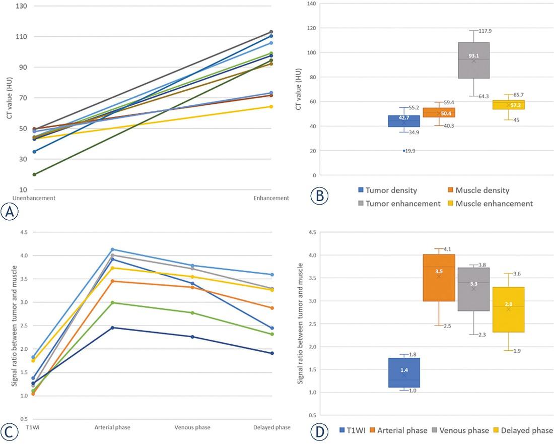 Enhancement trend charts of bladder paragangliomas on CT and MR images. (A) Broken line graph of enhancement trend on CT images; (B) Box plot of density distribution on pre- and post-contrast enhanced CT images (arterial phase); (C) Broken line graph of dynamic enhancement trend on MR images; (D) Box plot of signal distribution on unenhanced and dynamic contrast-enhanced MR images.