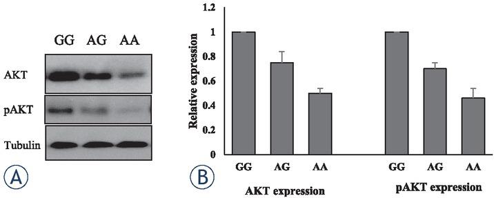Association of AKT rs1130233 single nucleotide polymorphism with AKT expression and phosphorylation (A) Representative images of immunoblotting showing expression of AKT and pAKT in lymphocytes of GG, AG and AA carriers. (B) Mean densitometry profile of AKT and pAkt expression of different subjects of various genotypes. P < 0.05 GG vs AG, and P < 0.01 GG vs AA.