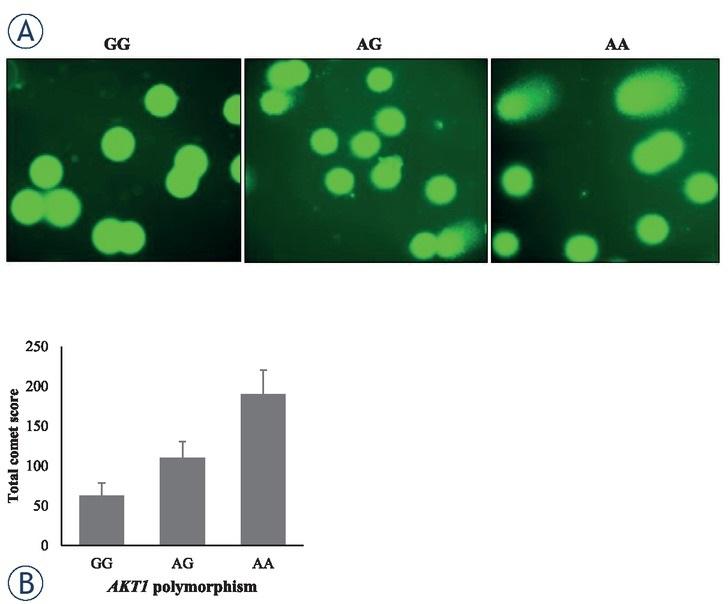 Association of AKT1 rs1130233 single nucleotide polymorphism with DNA damage. (A) Representative images of comet assay have been shown. (B) Comet tail was quantified in leukocytes of control individuals carrying GG, AG or AA genotypes of AKT1. P < 0.05 GG vs AG, and P < 0.01 GG vs AA.