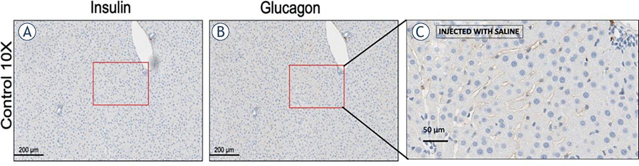 Liver tissue treated with non-thermal irreversible electroporation (NTIRE) and injected with PBS served as the control. Seven days after treatment with NTIRE and injection of PBS, immunohistochemical staining was performed on the controls using insulin and glucagon antibodies (University of Texas at Houston, USA). In the control slides, no cells were stained with insulin or glucagon antibodies, shown in (A) and (B), respectively. The higher magnification panel 4C shows normal hepatocytes with no evidence of scar tissue.