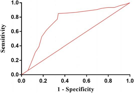 Receiver operating characteristic curve for distinguishing benign from malignant nodules using CT perfusion imaging parameter of permeability surface (PS).