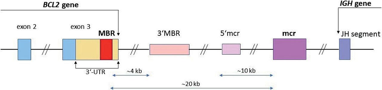Diagram of the BCL2/JH t(14;18) translocation breakpoints. Relative positions of major breakpoint region (MBR), 3′MBR subcluster, 5′mcr subcluster and minor cluster region (mcr) are shown according to the report of van Dongen JJM et al.16