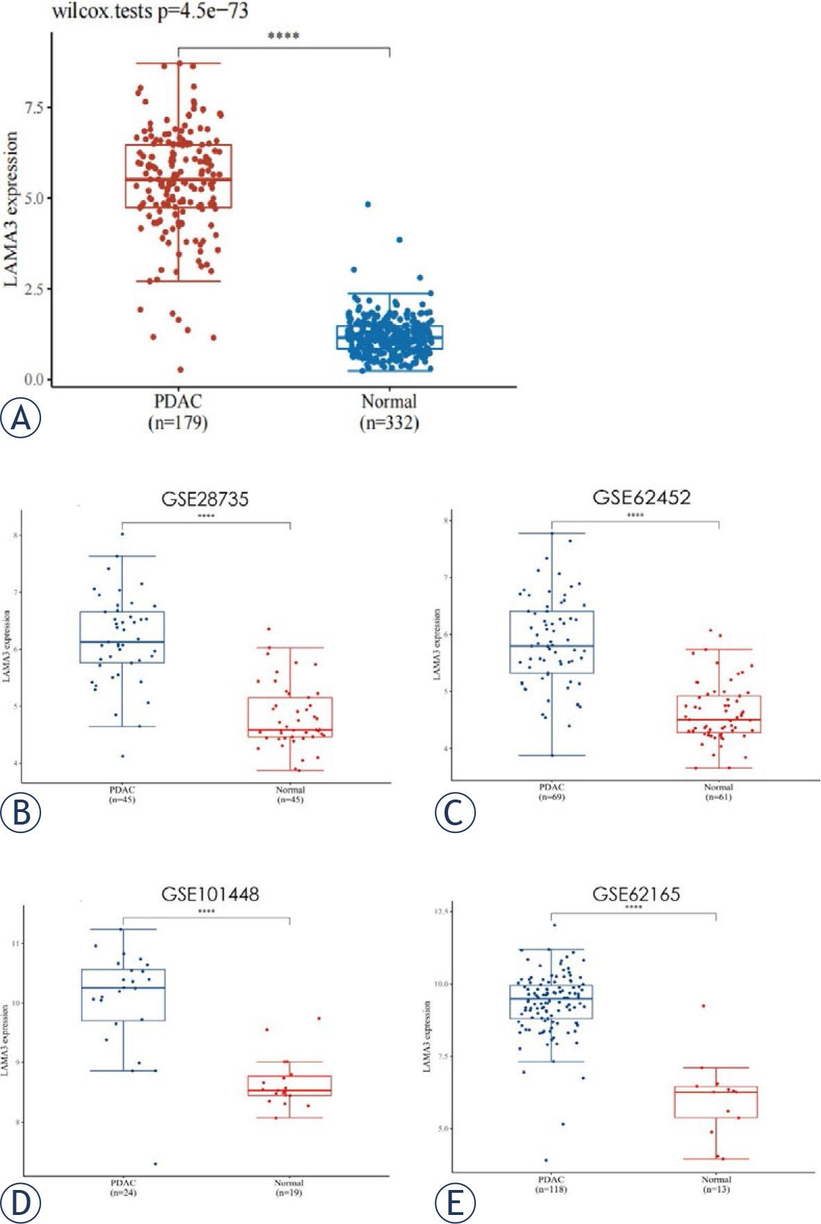 Expression of laminin subunit alpha 3 (LAMA3) in pancreatic ductal adenocarcinoma (PDAC) and normal tissues from the Cancer Genome Atlas (TCGA) database (A) and the Gene Expression Omnibus (GEO) database (B–E). Expression of LAMA3 in 179 PDAC and 332 normal tissues from TCGA (A); Expression of LAMA3 in 45 PDAC and 45 normal tissues from GSE28735 cohort (B); Expression of LAMA3 in 69 PDAC and 61 normal tissues from GSE62452 cohort (C); Expression of LAMA3 in 24 PDAC and 19 normal tissues from GSE101448 cohort (D); Expression of LAMA3 in 118 PDAC and 13 normal tissues from GSE62165 cohort (E).****P < 0.001.