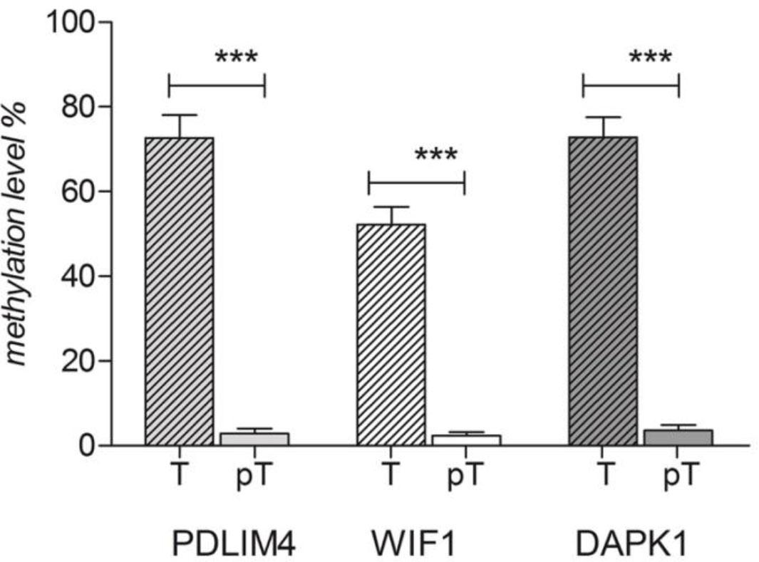 Methylation percentages of PDLIM4, DAPK1 and WIF 1 genes’ promoters in neoplastic (T) and peri-neoplastic (PT) laryngeal tissues