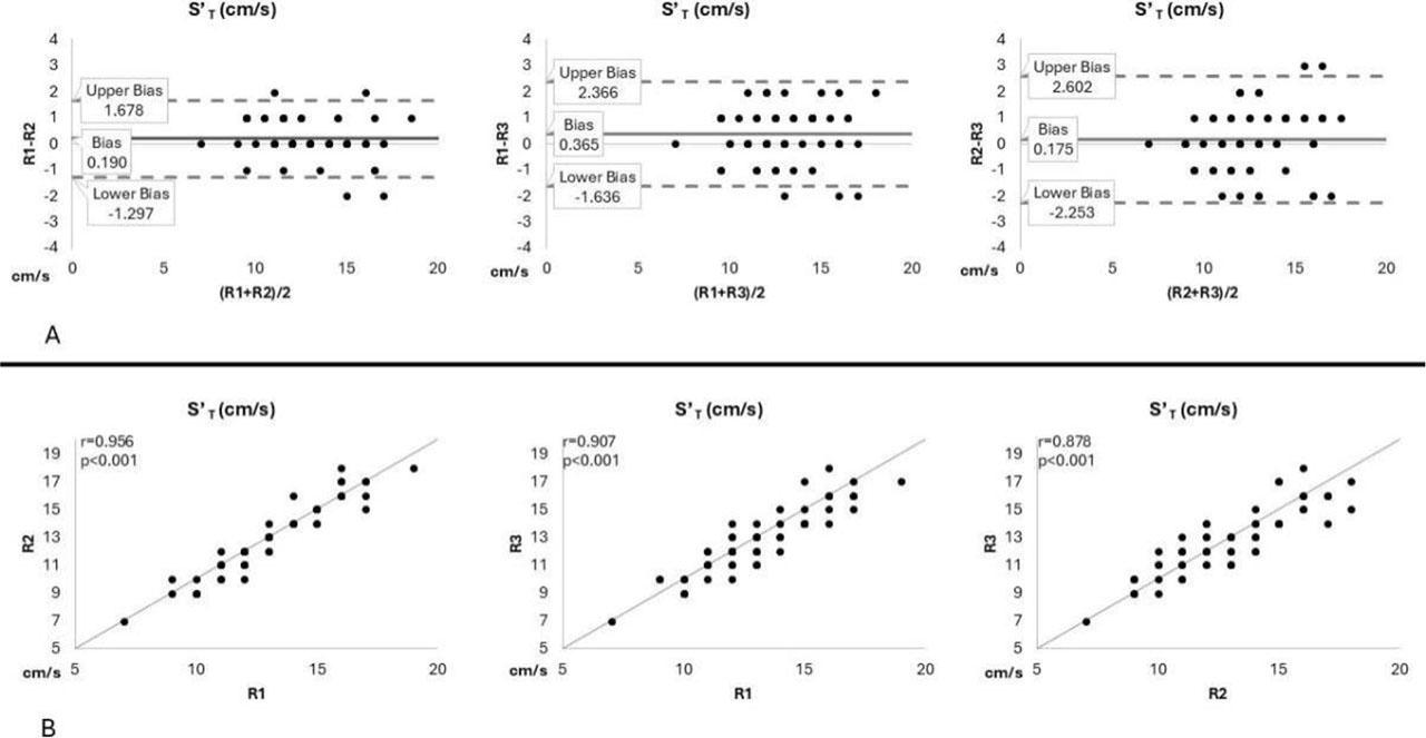 Bland-Altman plots (panel A) and correlations (panel B) for measurements of right ventricular systolic wave velocity (S’t) by advanced (R1), intermediate (R2), and beginner (R3) readers.