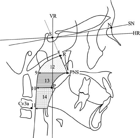 Linear and area measurements. 8. PNS-R; 9. PNS-PPW1; 10. P-PPW2; 11. APW3-PPW3; 12. Nasopharyngeal; 13. Oropharyngeal; 14. Hypopharyngeal.