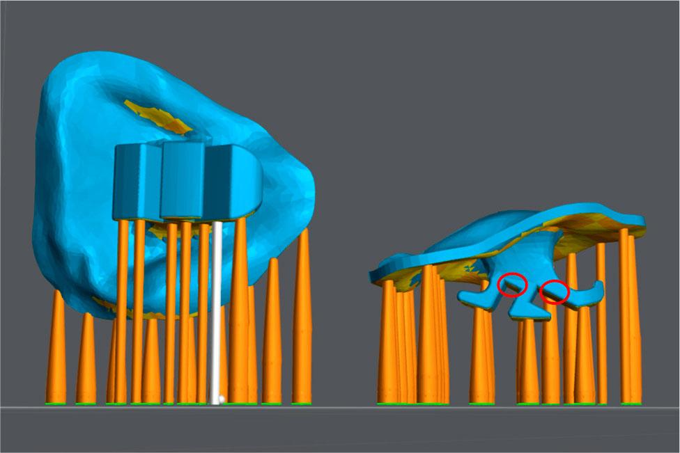 Correct orientation of the bracket during 3D printing (left). Incorrect orientation leads to unsupported areas (red) which would be incorrectly printed (right).