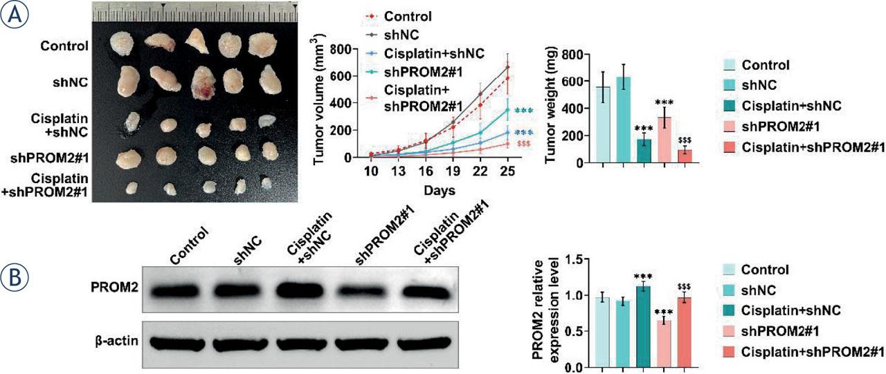 PROM2 enhances cisplatin resistance in lung cancer cells in vivo. BALB/c nude mice were subcutaneously injected with PROM2 knockdown stable A549/DDP cells. One week later, cisplatin (4 mg/kg) was injected into the peritoneum every 3 days. After 30 days, the cells were removed and the volume and weight were measured. (A) The volume and weight of tumors in different groups were detected. (B) The protein levels of PROM2 in different groups were detected by Western blotting.***P < 0.001 compared with shNC group; $P < 0.05, $$P < 0.01, $$$P < 0.001 compared with cisplatin+shNC