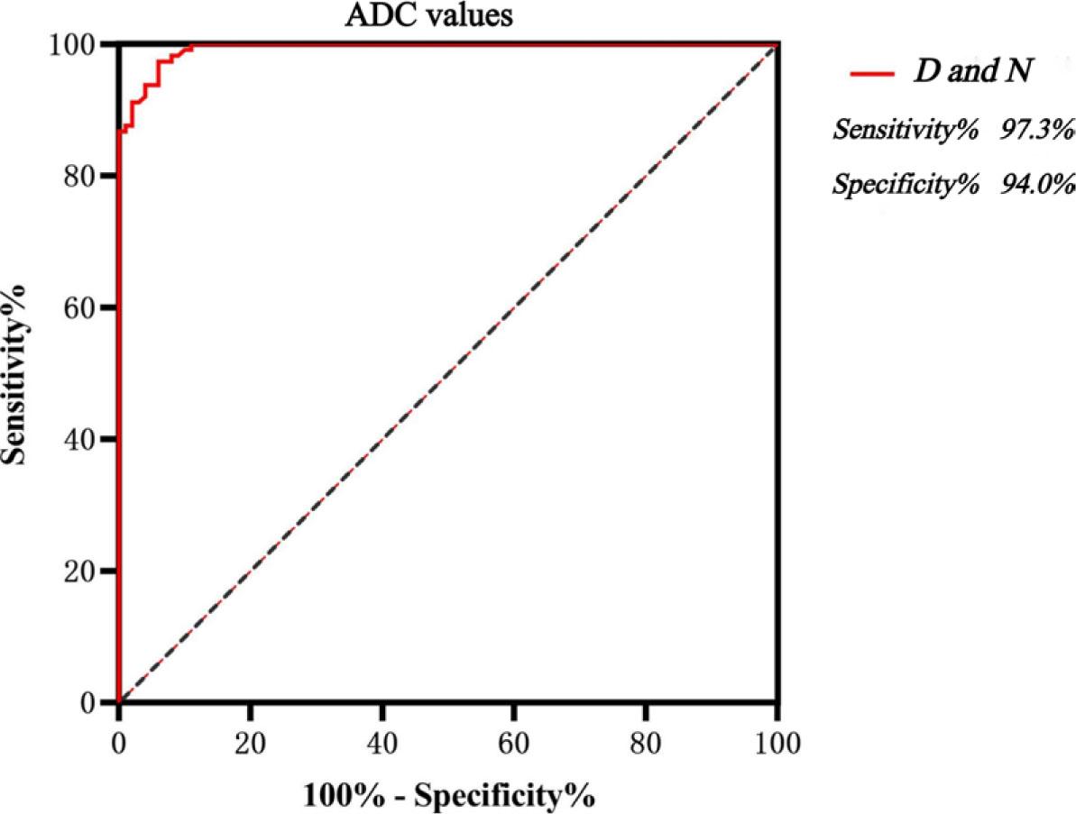 ROC curve analysis of discriminating multiple myeloma (MM) infiltration patterns of D from N by quantitative parameters of apparent diffusion coefficient (ADC).D = pure diffuse pattern; N = normal pattern