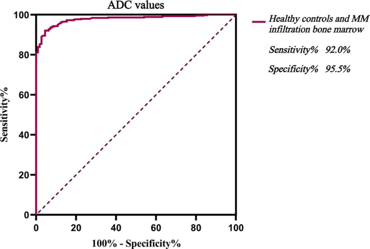 ROC curve analysis of discriminating healthy controls from multiple myeloma (MM) infiltration bone marrow by quantitative parameters of apparent diffusion coefficient (ADC).