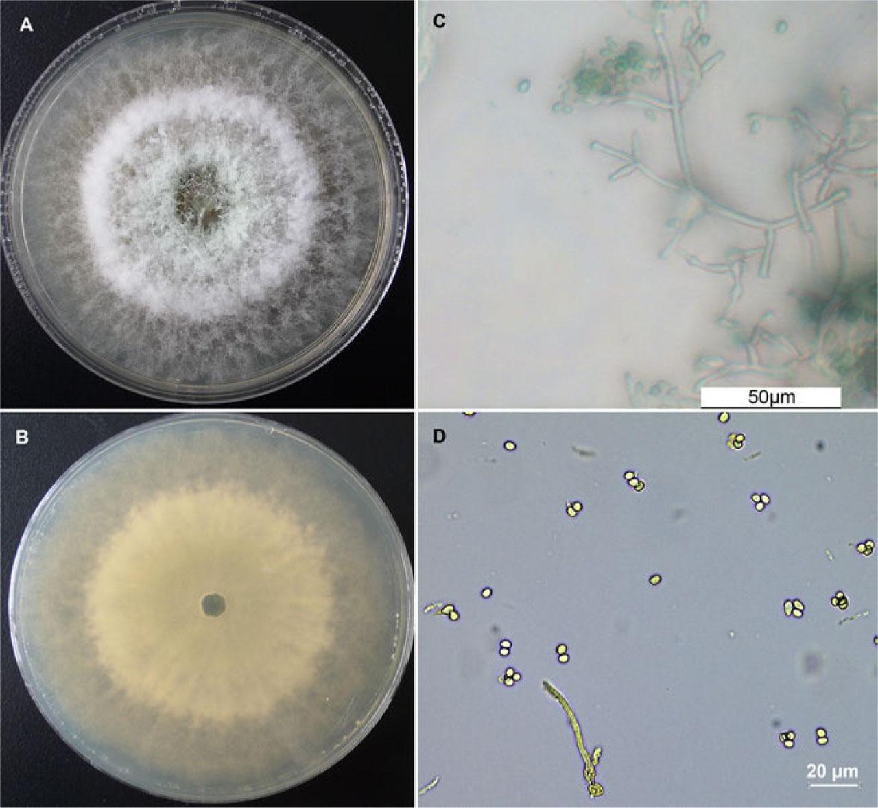 Morphological characteristics of strain TM11.A–B) colony of TM11 surface and base, C) conidiophores, D) conidia (scale 20 microns).