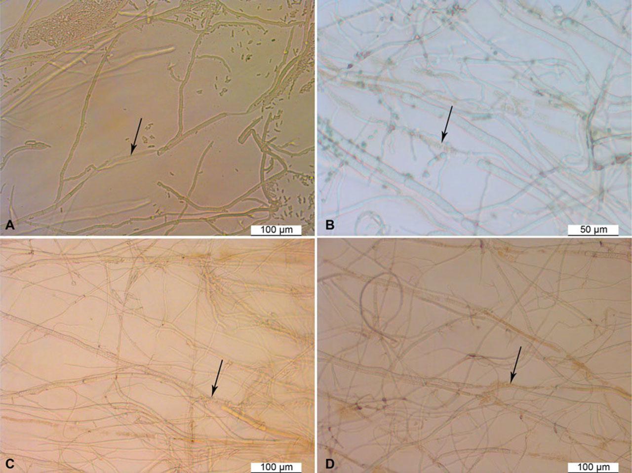 Inhibition of Fusarium oxysporum and Fusarium commune hyphal growth by Trichoderma asperellum strain TM11 under a microscope.A) Strain TM11 causes lysis of F. oxysporum lysis of the hyphae (as shown by arrow), B) strain TM11 causes F. oxysporum lysis of the hyphae, and the cytoplasm has leaked out of that hyphal (as shown by arrow), C) strain TM11 to coil around the hyphae of F. commune (as shown by arrow), D) strain TM11 causes F. commune lysis of the hyphae, and the cytoplasm has leaked out of that hyphal (as shown by arrow).