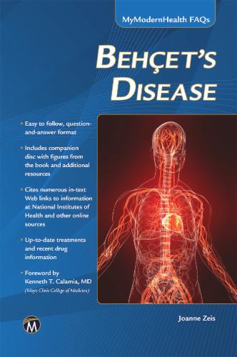 Behcet’s Disease