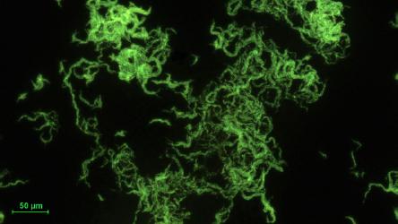 Mycobacterium abscessus subsp. abscessus. Photography of an auramine-stained acid-fast bacilli smear from liquid BBL culture. The visible bacilli forming cord-like structures.