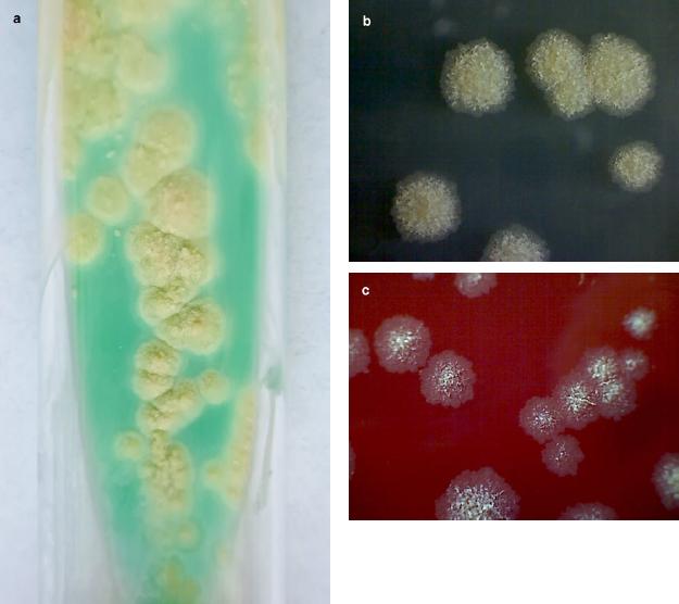 Growth of Mycobacterium abscessus after 7 days of incubation at 37°C in aerobic condition.
a) cream-colored, waxy colonies on Löwenstein-Jensen medium
b) mycobacterial colonies on non-selective media – Tryptic Soy Agar
c) mycobacterial colonies on Columbia agar with 5% of sheep blood.