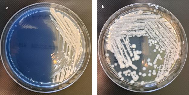 Culture of rapidly growing non-tuberculous mycobacteria on selective NTM Elite agar (bioMérieux, France), after 5 days of incubation at 37°C under aerobic conditions.
a) colonies of Mycobacterium fortuitum subsp. fortuitum ATCC® 6841™, b) rough colonies of Mycobacterium abscessus subsp. abscessus.