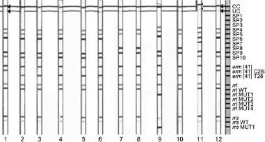 Analysis of the banding patterns received for 12 clinical strains (strips 1-12) with the use of GenoType NTM DR (Hain Lifescience GmbH, Germany). The strips coated with specific probes are complementary to selectively amplified nucleic acid sequences, that enable species determination as well as point mutations referring to resistance to aminoglycosides and macrolides.
