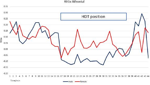 Averages of male and female groups bifrontal REGx during rest and HDT position. The correlation coefficient is 0.49; the statistical significance is 0.03. Note the difference during HDT. During this period, the correlation coefficient is 0.21; the statistical significance is p=0.0002. REGx decreased at the start of HDT, indicating the active status of CBF AR.