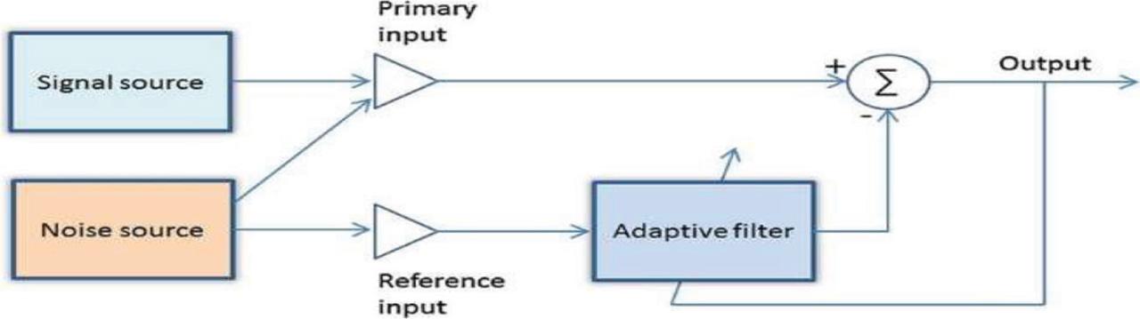Block diagram of ANC. ANC, adaptive noise canceller.