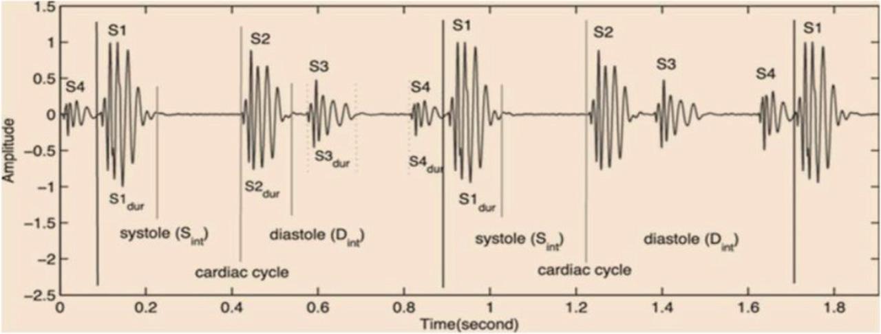 Different segments in Heart Sound.