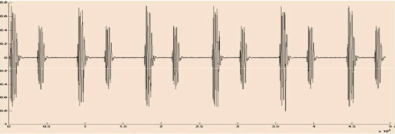 PCG of a normal cardiac Heart Sound. PCG, phonocardiogram.