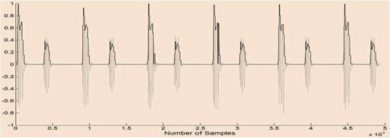 Shannon energy envelogram of the PCG of a normal Heart Sound. PCG, phonocardiogram.