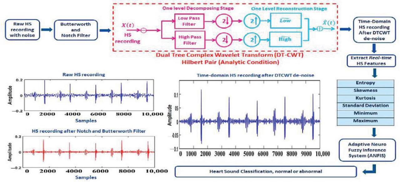 Schematic diagram of Heart Sound analysis using DWT. ANFIS, adaptive neuro fuzzy inference system; DWT, discrete wavelet transform; DT-CWT, dual tree complex wavelet transform.