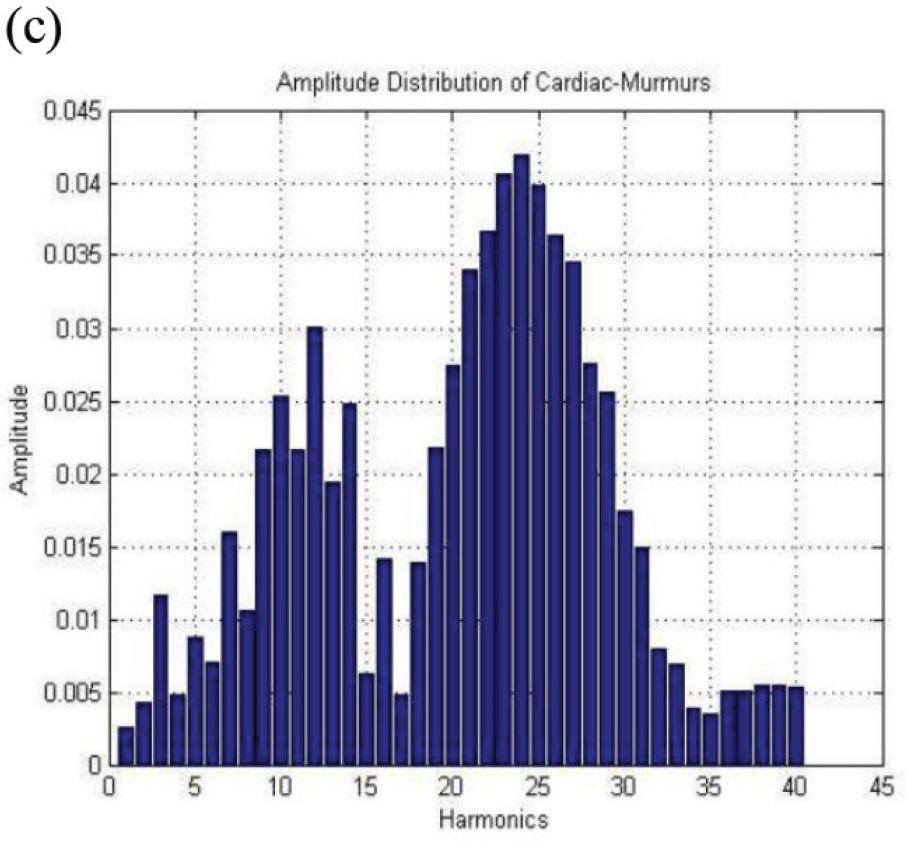Amplitude distribution of Murmurs.