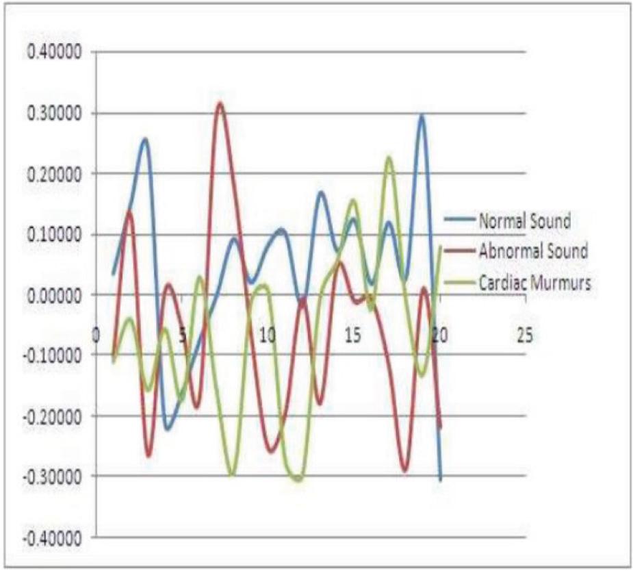 Comparison of different Heart Sounds.