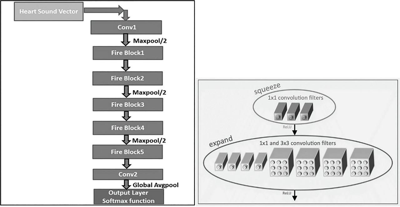 Schematic block diagram of Squeeze Net.