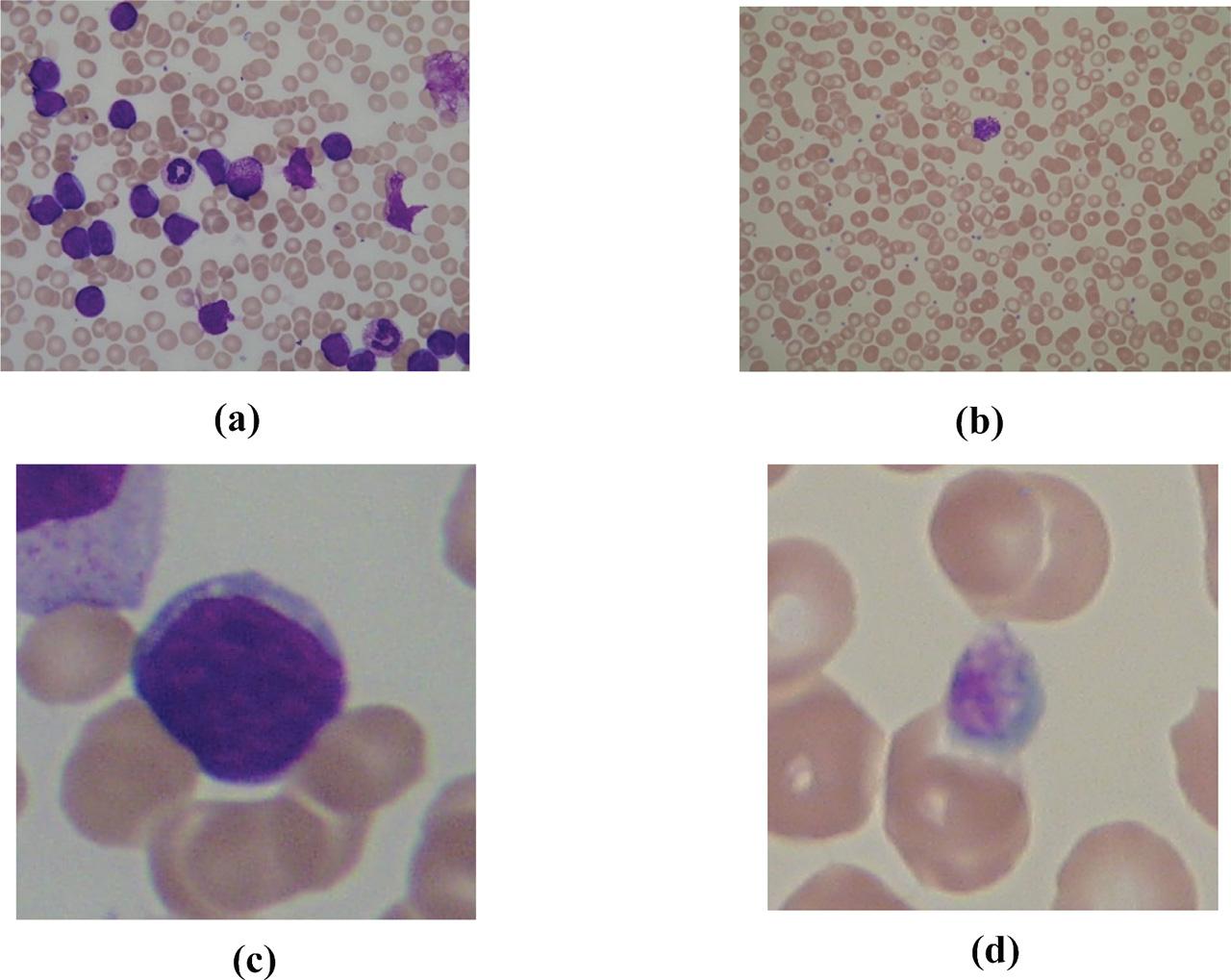 (a) ALL-IDB-1 infected image; (b) ALL-IDB-1 normal image; (c) ALL-IDB2 infected image, and (d) ALL-IDB2 normal image.
