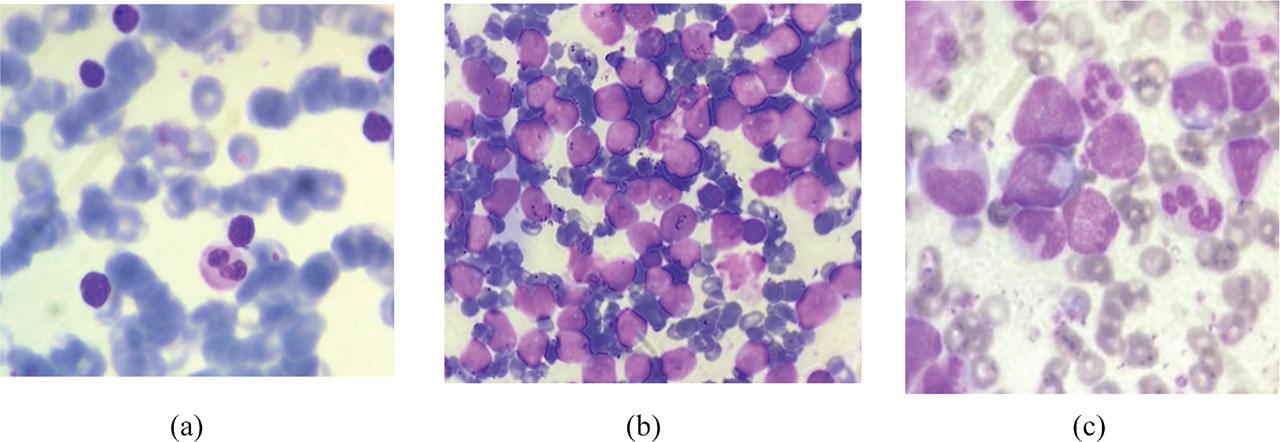 Images from the real-image dataset: (a) CLL, (b) CML, and (c) AML. AML, acute myeloid leukemia; CLL, chronic lymphocytic leukemia; CML, chronic myeloid leukemia.