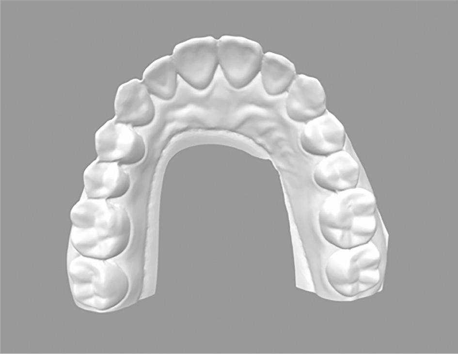 Master maxillary .STL file after scanning.