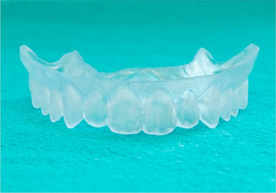 Aligner obtained after finishing and polishing.