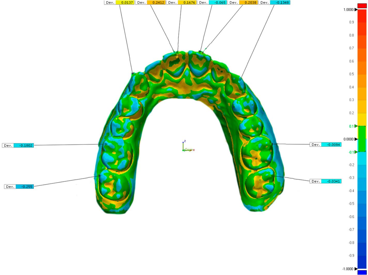 Image generated by Geomagic Control software showing location-specific deviations at specific landmarks.
