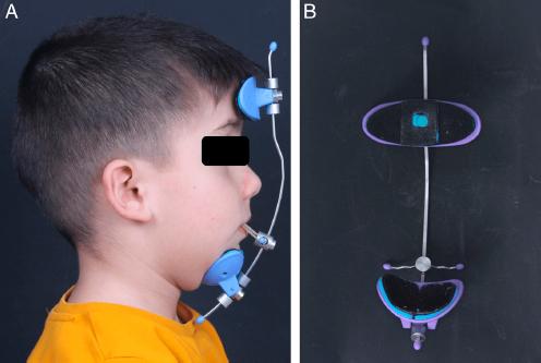 Application of the face mask (A) and the microsensor incorporation into the forehead pad (B).