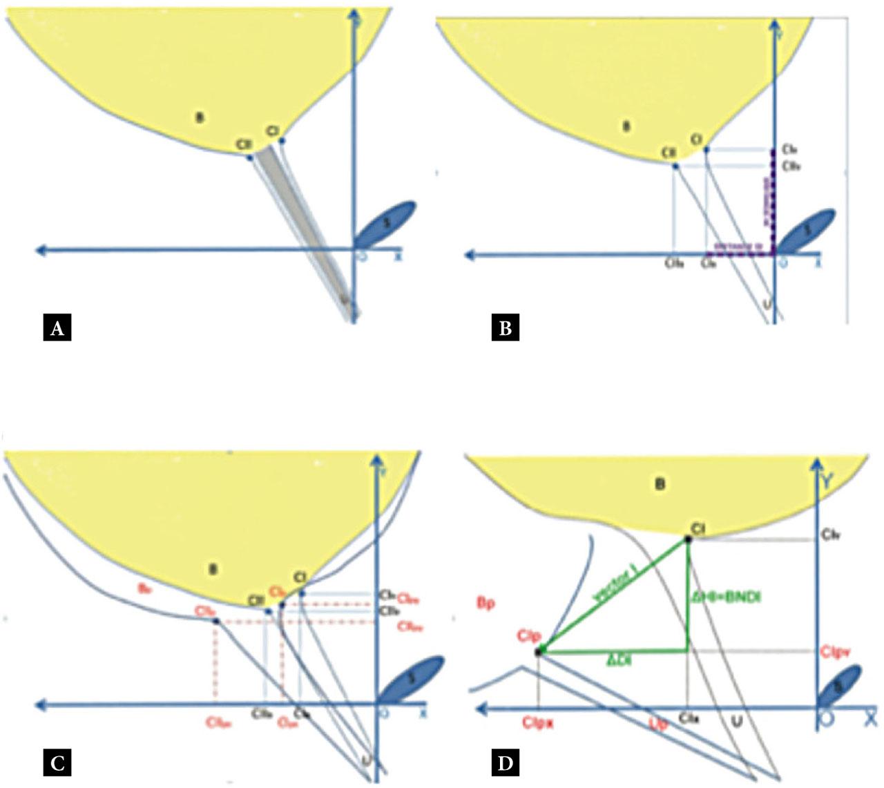 A diagram showing ultrasound parameters of the internal urethral opening at rest and during the Valsalva maneuver. A. Location of CI and CII points within the internal urethral opening. B. Location of points CI and CII on the OY and OX axes. C. Location of points CI and CII (at rest), as well as Ci p and CII p (during the Valsalva maneuver) on the OY and OX axes. D. Calculation of bladder neck descent parameters: BND and vector; S – pubic symphysis; B – urinary bladder; U – urethra; CI and CII – points referring to the internal urethral opening at rest; CI x and CII x – projection of CI and CII points on the OX axis; CI y and CII y – projection of CI and CII points on the OY axis; B p – urinary bladder at maximum pressure; Ci p and CII p – points locating the internal urethral opening during the Valsalva maneuver; CI px and CII px – projection of the points CI p and CII p on the OX axis; CIpy and CII p – projection of CIp and CIIp points on the OY axis; ∆HI – BND for the CI point during the Valsalva maneuver; Vector I – vector for the CI point during the Valsalva maneuver