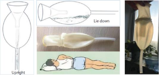Double layer funnel structure design
(source: drawn by the author and experimental results obtained by the author)