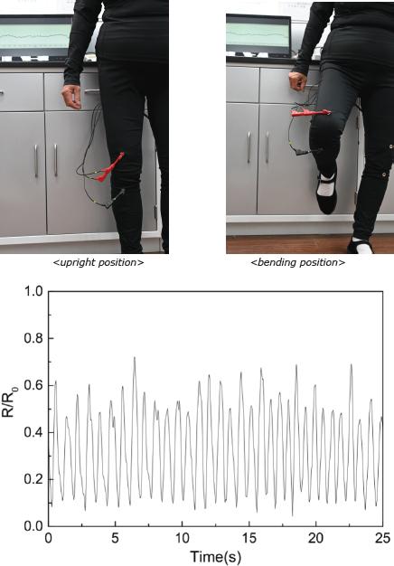 Resistance variation of the knee motion monitoring sensor