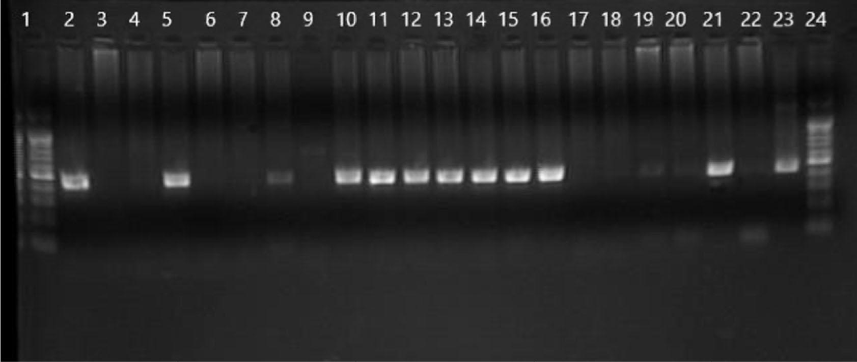 Shows agarose gel electrophoresis for nested PCR products stained with 0.2 mg/ml ethidium bromide, using primers species specific for Entamoeba histolytica. Positive samples reveal 439 bp bands at lanes 2, 5, 8, 10–16, 19, and 21.
Lane 23 represented positive control, while lane 22 represented negative control, and lane 1 is the 100 bp DNA marker.