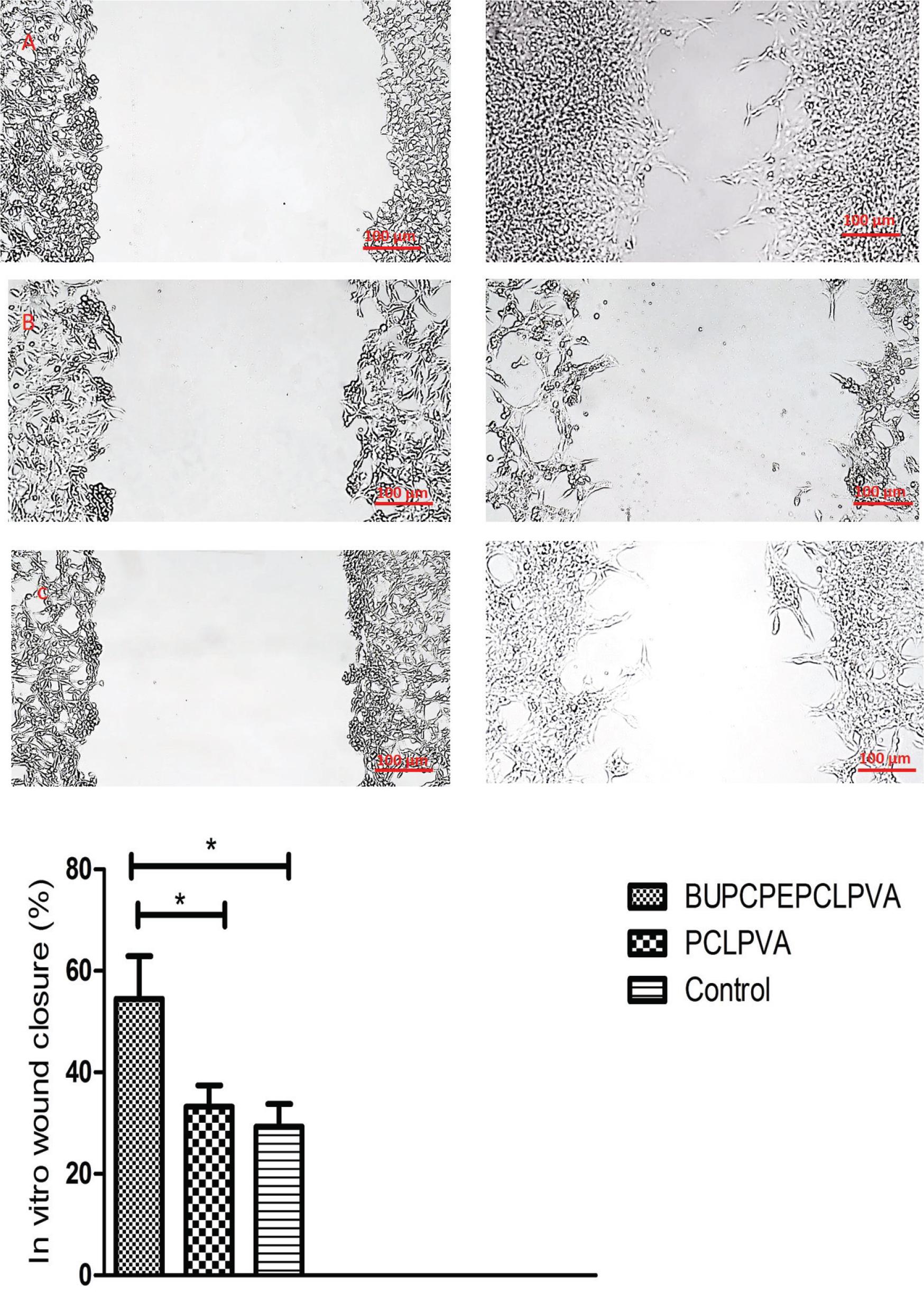 In vitro wound closure assessment with L929 cells cultured with (A) BUPCPEPCLPVA scaffolds extract, (B) PCLPVA scaffolds’ extract, (C) normal culture media as the control group, * shows p-value < 0.05