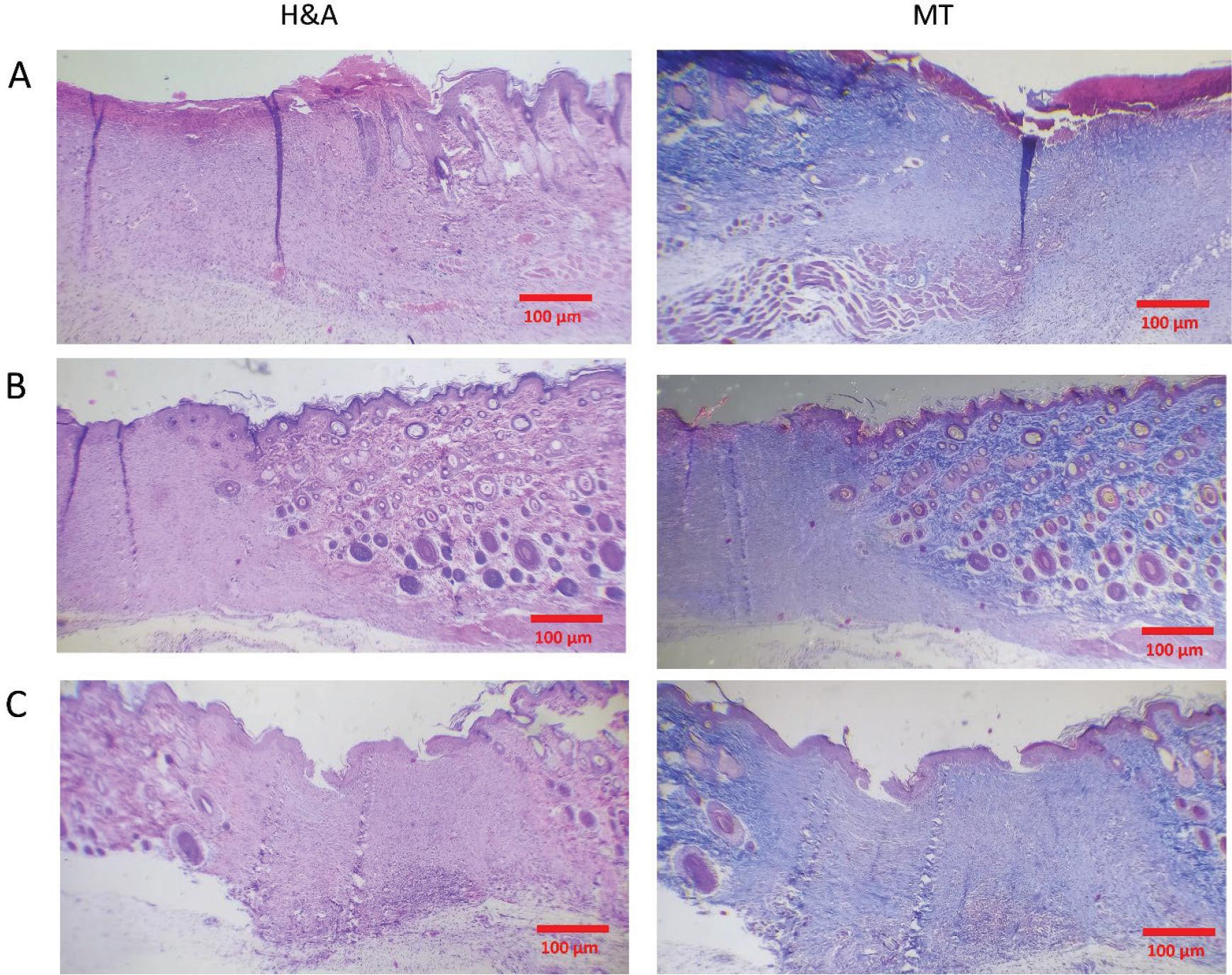 Hematoxylin and Eosin (H&E) and Masson’s Trichrome (MT) staining images of wounds treated with (A) BUPCPEPCLPVA, (B) PCLPVA, and (C) control groups