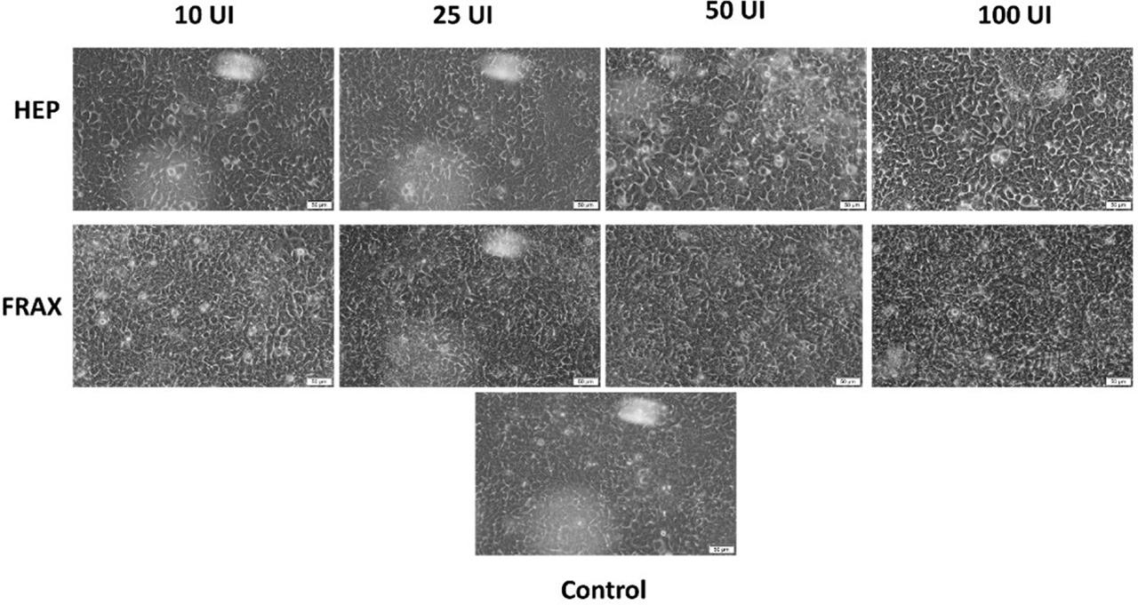 Images showing the confluence and morphological aspect of HCT 116 colorectal carcinoma cells after 72 h of treatment with HEP and FRAX at 10, 25, 50 and 100 UI. The scale bars represent 50 µm.