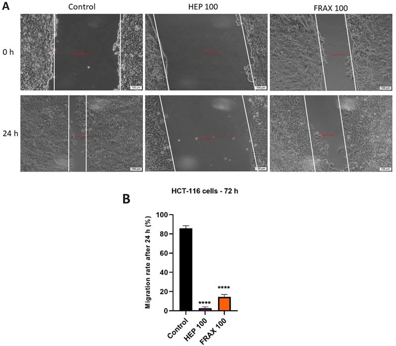 A) Pictures illustrating the migratory capacity of HCT 116 cells after treatment with HEP 100UI and FRAX 100UI for 24h. The scale bars represent 50 µm. B) Graphic depiction of the migratory potential of HCT 116 cells after the treatment with HEP 100UI and FRAX 100UI. The bar graphs are exposed as % of wound closure after 24 hours compared to the initial distance at t0. The results are expressed as averages ± SD of 3 independent experiments. One-way ANOVA analysis and the Dunett’s multiple comparisons post-test were applied to follow the statistical differences between obtained results (**** p < 0.0001).