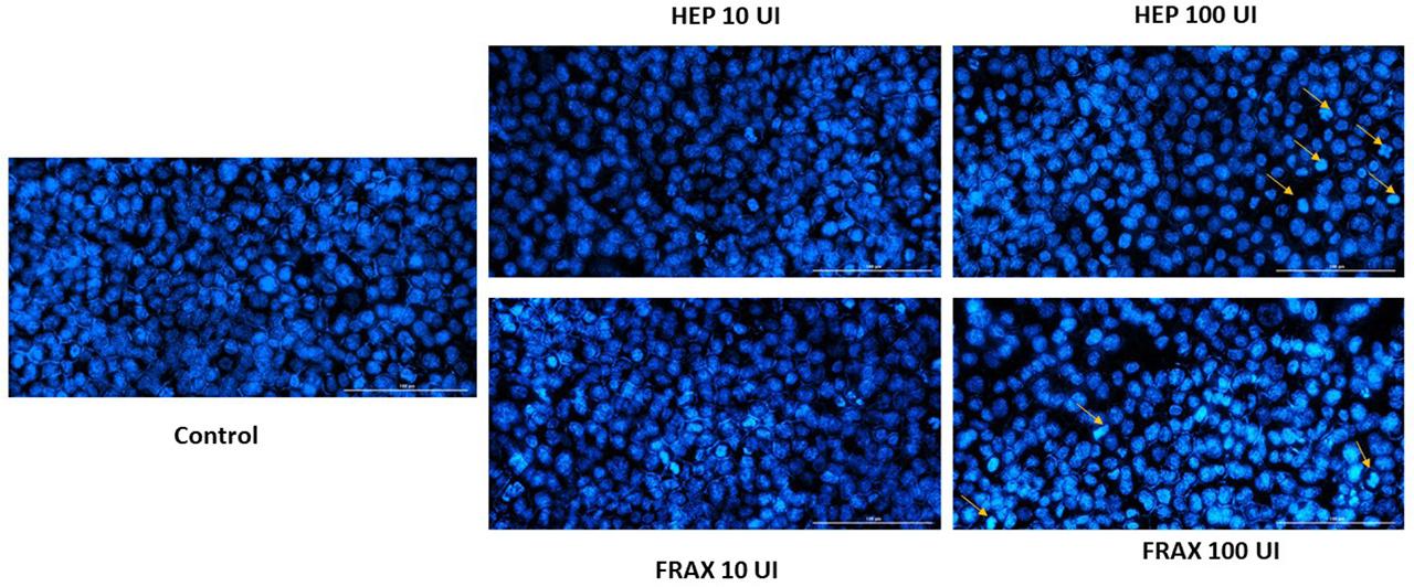 Pictures of the HCT 116 cellular nuclei counterstained with Hoechst 33342 reagent after 72 h of treatment with HEP and FRAX 10 and 100UI. The yellow arrows assign nuclei with apoptotic signs. The scale bars represent 100 µm.