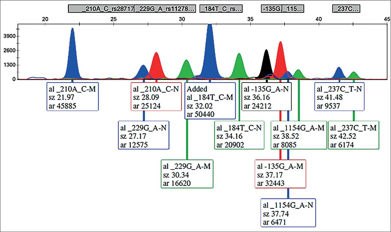 Electrophoretogram of an individual heterozygous for all ANXA5 and VEGFA examined variants.