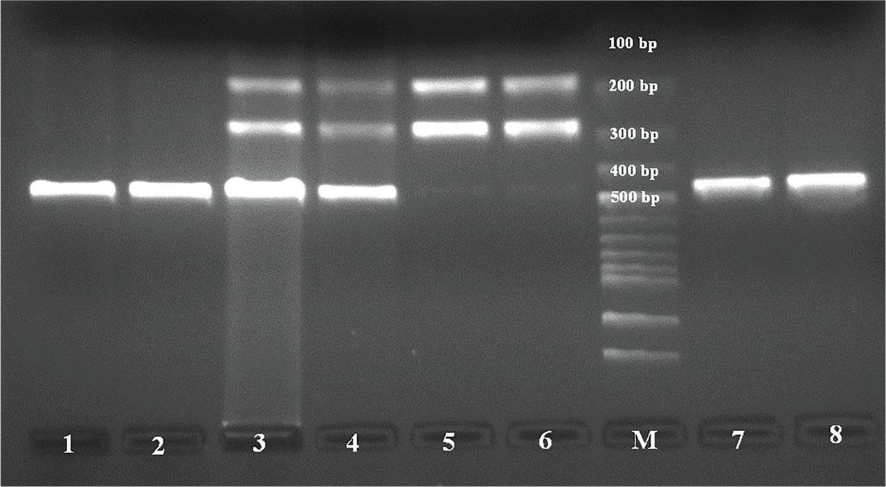 Electrophoresis of ACE2 G8709A (rs2285666) gene polymorphism by enzyme digestion product sizes were 466 bp for GG genotype, 185 bp–281 bp–466 bp for GA genotype, and 185 bp–281 bp for AA genotype. Lanes 1 and 2 are the GG genotype; lanes 3 and 4 are the GA genotype; lanes 5 and 6 are the AA genotype; lanes 7 and 8 are the PCR products (466 bp). ACE2, angiotensin-converting enzyme 2; M, DNA molecular weight marker.